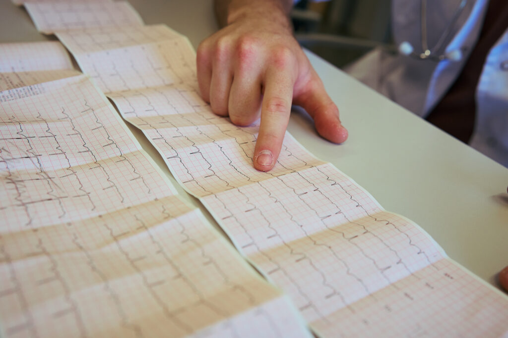 ecg diagnosis near me