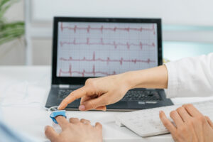 ecg diagnosis at bengaluru