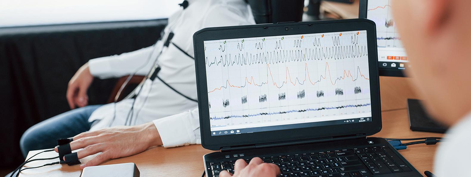 tricog ecg repoting system, portable ecg machine