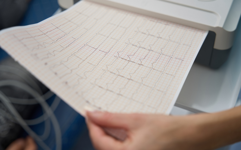 ecg diagnosis
