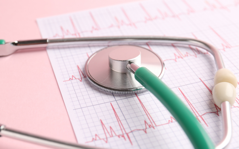 ecg diagnosis