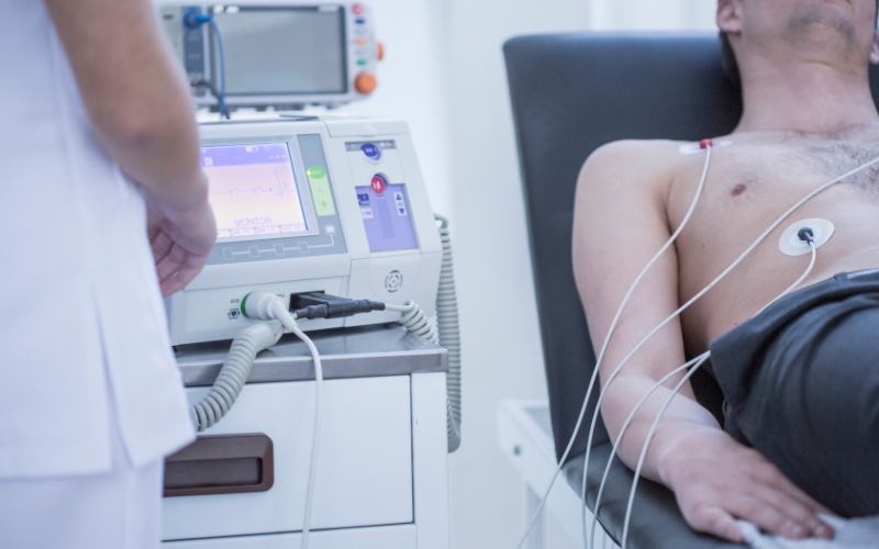 ecg monitoring