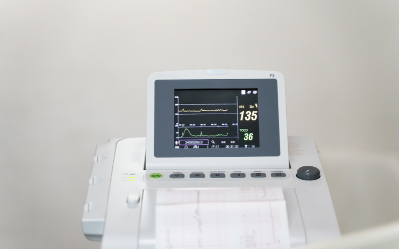 portable ecg machine
