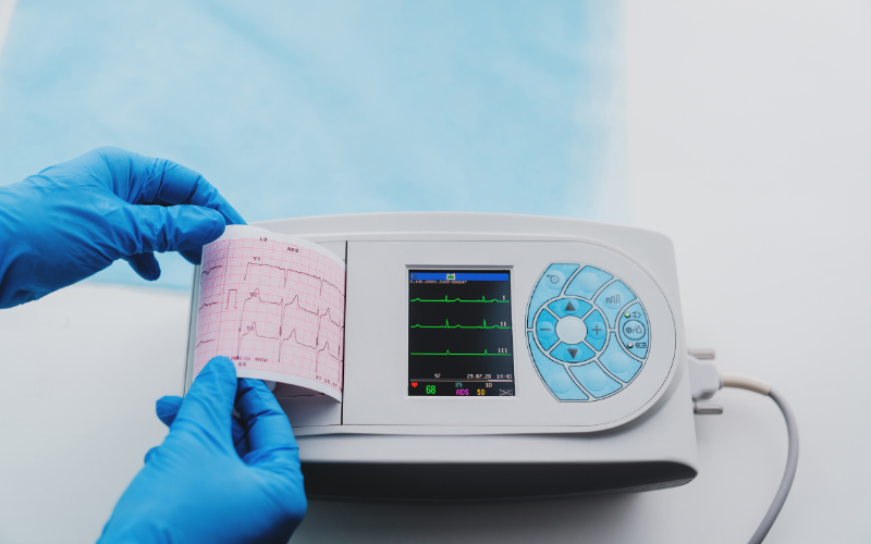 portable ecg machine