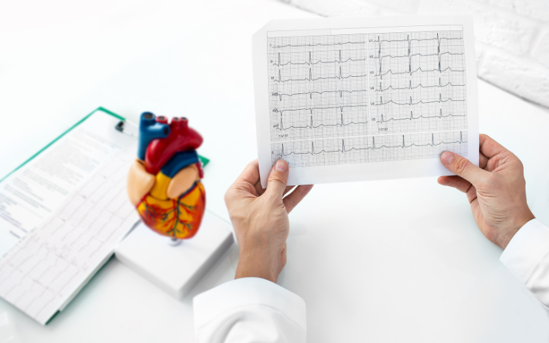 ecg - heartnet india