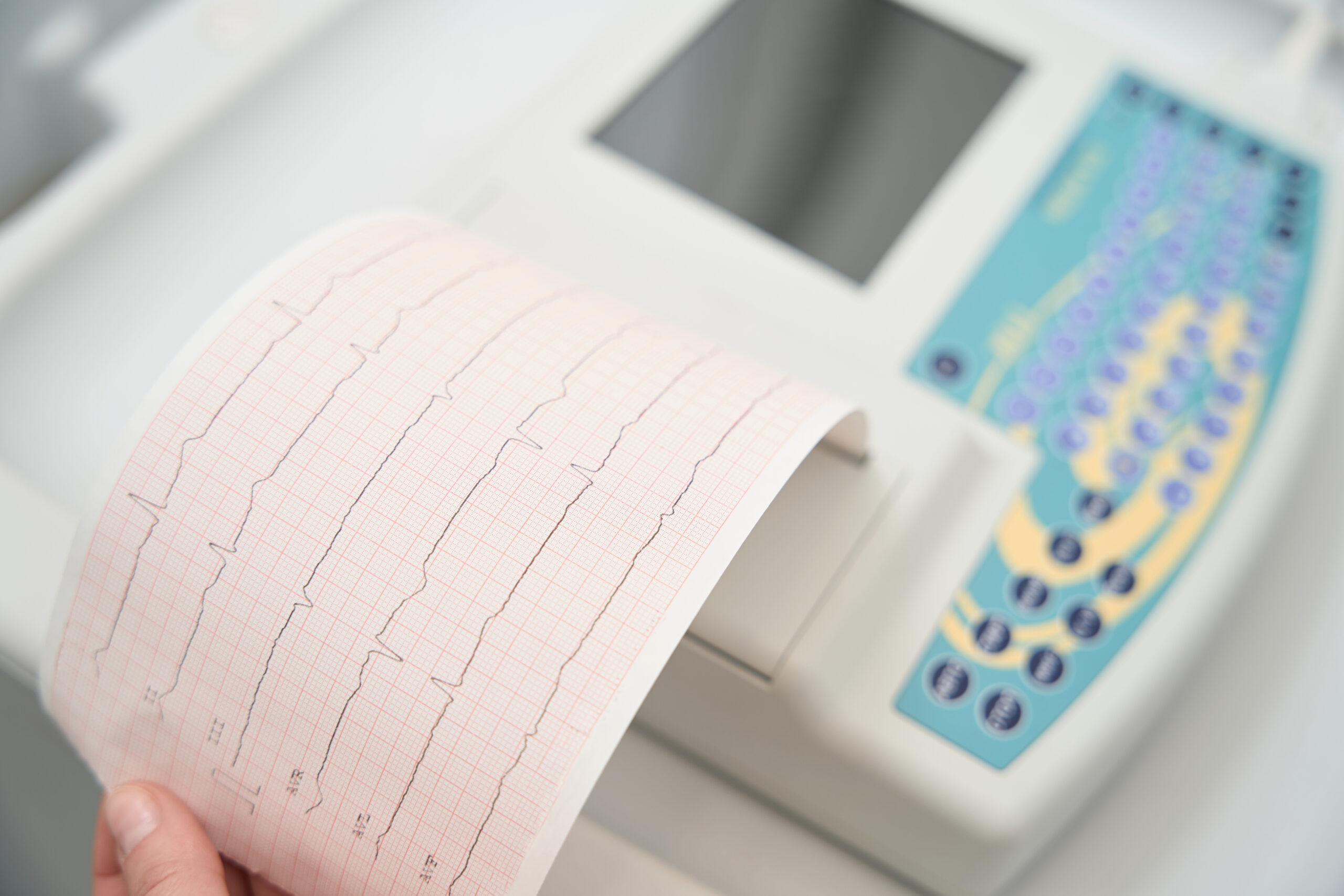 ecg machine