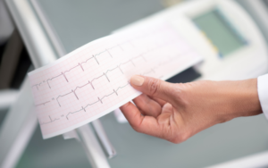 ecg reporting service