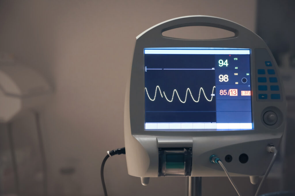 portable ecg machine